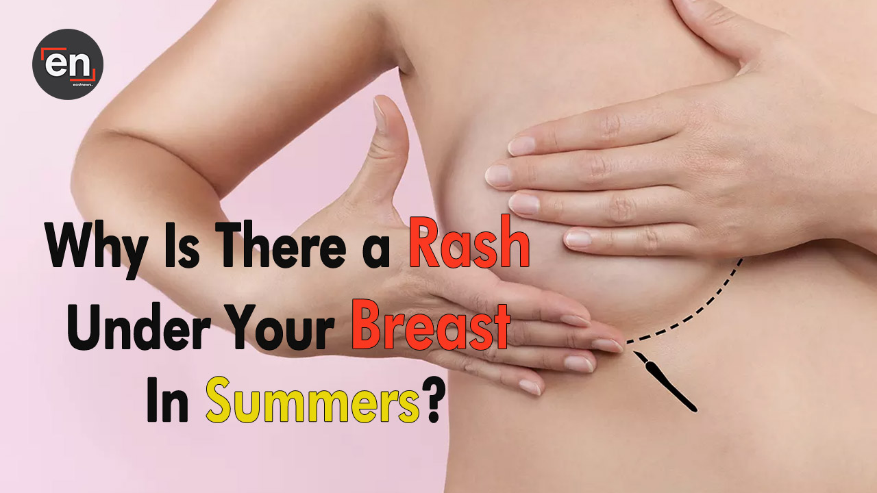 Why Is There a Rash Under Your Breast In Summers? Life Style